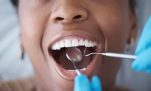 A woman smiles while getting a deep cleaning from the dentist