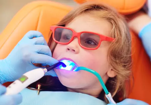 A child having Silver Diamine Fluoride used to fill her baby teeth