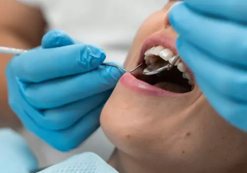 Holistic Dental Services East Peoria IL 1 Holistic Dental Services East Peoria IL
