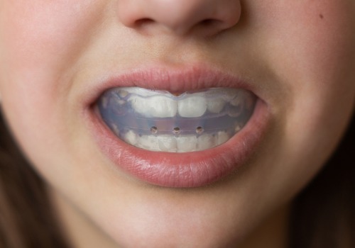 Girl showing mouth with a HealthyStart® application